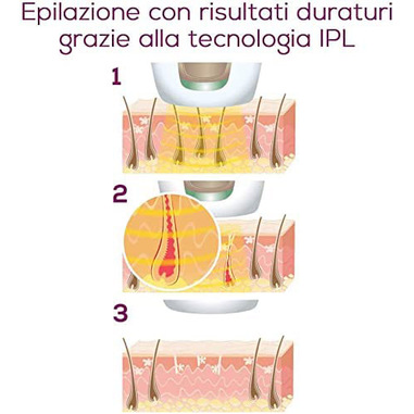 Foto 5 su 8 del prodotto