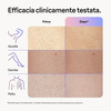 Miniatura prodotto Braun Epilatore Luce Pulsata Smart Skin I·Expert, Epilazione A Casa Tua, Custodia, Rasoio Donna Venus, 2 Testine, PL7147