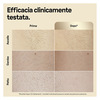 Miniatura prodotto Braun Epilatore Luce Pulsata Silk·expert Pro 5, Epilazione A Casa Tua, Con Custodia, Rasoio Donna Venus, 2 Testine, PL5152