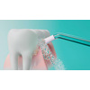 Miniatura prodotto Idropulsore Irrigatore orale senza fili HX3826/31